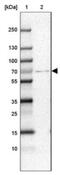 CPT2 antibody, NBP1-85470, Novus Biologicals, Western Blot image 