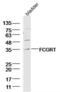 Fc Fragment Of IgG Receptor And Transporter antibody, orb156854, Biorbyt, Western Blot image 