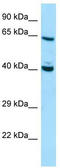 DnaJ homolog subfamily C member 7 antibody, TA338234, Origene, Western Blot image 