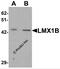 LIM homeobox transcription factor 1-beta antibody, 7089, ProSci Inc, Western Blot image 