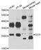 GC-A antibody, PA5-77127, Invitrogen Antibodies, Western Blot image 