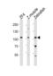 ATP/GTP Binding Protein Like 2 antibody, LS-C344703, Lifespan Biosciences, Western Blot image 
