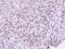 Zinc Fingers And Homeoboxes 2 antibody, NBP1-33415, Novus Biologicals, Immunohistochemistry frozen image 
