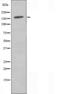 RAB3 GTPase Activating Non-Catalytic Protein Subunit 2 antibody, orb226823, Biorbyt, Western Blot image 
