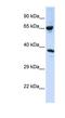 Alpha Tubulin Acetyltransferase 1 antibody, NBP1-57650, Novus Biologicals, Western Blot image 