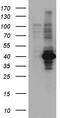 Essential Meiotic Structure-Specific Endonuclease Subunit 2 antibody, A13928, Boster Biological Technology, Western Blot image 