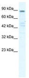 Potassium voltage-gated channel subfamily KQT member 2 antibody, TA338751, Origene, Western Blot image 
