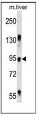RAS Protein Activator Like 1 antibody, AP53584PU-N, Origene, Western Blot image 