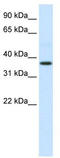 Alpha 2-HS Glycoprotein antibody, TA334286, Origene, Western Blot image 