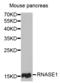 Ribonuclease pancreatic antibody, A03553, Boster Biological Technology, Western Blot image 