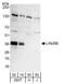 Lin-28 Homolog B antibody, A303-588A, Bethyl Labs, Western Blot image 