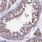 Ring Finger Protein 17 antibody, HPA040111, Atlas Antibodies, Immunohistochemistry paraffin image 