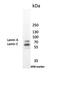 Lamin A/C antibody, ab8984, Abcam, Western Blot image 
