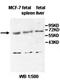 Phosphatase and actin regulator 4 antibody, orb78000, Biorbyt, Western Blot image 