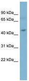 STE20-related kinase adapter protein alpha antibody, TA330986, Origene, Western Blot image 