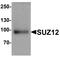 SUZ12 Polycomb Repressive Complex 2 Subunit antibody, TA326710, Origene, Western Blot image 