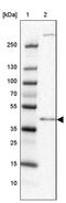 Chromosome 4 Open Reading Frame 17 antibody, PA5-63878, Invitrogen Antibodies, Western Blot image 