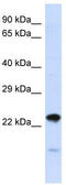 Nipsnap Homolog 3A antibody, TA331952, Origene, Western Blot image 