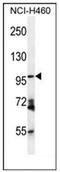 Glutamyl Aminopeptidase antibody, AP51433PU-N, Origene, Western Blot image 