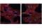 Sequestosome 1 antibody, 39786S, Cell Signaling Technology, Immunocytochemistry image 
