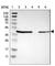 Uroplakin 3B antibody, HPA010506, Atlas Antibodies, Western Blot image 
