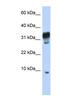 Peroxisomal Testis Enriched Protein 1 antibody, NBP1-70693, Novus Biologicals, Western Blot image 