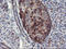 Phosphofructokinase, Platelet antibody, LS-C797521, Lifespan Biosciences, Immunohistochemistry paraffin image 