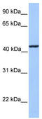 Kinesin Light Chain 3 antibody, TA337566, Origene, Western Blot image 
