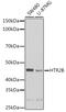 5-Hydroxytryptamine Receptor 2B antibody, GTX32984, GeneTex, Western Blot image 
