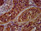 Rho GTPase-activating protein 15 antibody, LS-C680176, Lifespan Biosciences, Immunohistochemistry paraffin image 