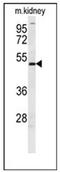 Doublesex And Mab-3 Related Transcription Factor 3 antibody, AP51279PU-N, Origene, Western Blot image 
