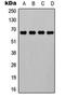 Ephrin A2 antibody, orb315774, Biorbyt, Western Blot image 