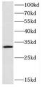 Cytochrome B5 Reductase 3 antibody, FNab02116, FineTest, Western Blot image 