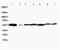 Mitogen-Activated Protein Kinase 8 antibody, PA1407, Boster Biological Technology, Western Blot image 