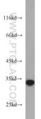 5'-Nucleotidase, Cytosolic IIIA antibody, 11393-1-AP, Proteintech Group, Western Blot image 