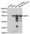 Membrane Palmitoylated Protein 1 antibody, A6298, ABclonal Technology, Western Blot image 
