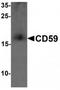 Membrane attack complex inhibition factor antibody, TA319628, Origene, Western Blot image 