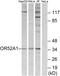 Olfactory Receptor Family 52 Subfamily A Member 1 antibody, PA5-39832, Invitrogen Antibodies, Western Blot image 