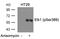ETS Transcription Factor ELK1 antibody, GTX50688, GeneTex, Western Blot image 