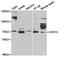 Cadherin 13 antibody, TA327168, Origene, Western Blot image 