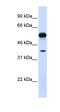 Dimethylarginine Dimethylaminohydrolase 1 antibody, orb330784, Biorbyt, Western Blot image 