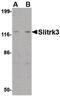 SLIT And NTRK Like Family Member 3 antibody, PA5-20473, Invitrogen Antibodies, Western Blot image 