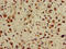 ASH1 Like Histone Lysine Methyltransferase antibody, orb52066, Biorbyt, Immunohistochemistry paraffin image 