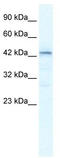 SP140 Nuclear Body Protein Like antibody, TA341448, Origene, Western Blot image 