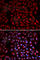 Retinoic Acid Receptor Alpha antibody, A0370, ABclonal Technology, Immunofluorescence image 