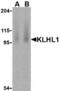 Kelch Like Family Member 1 antibody, TA306098, Origene, Western Blot image 