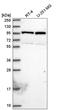 N(Alpha)-Acetyltransferase 15, NatA Auxiliary Subunit antibody, HPA050661, Atlas Antibodies, Western Blot image 