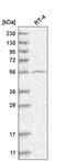 G Protein-Coupled Receptor Kinase 4 antibody, HPA028737, Atlas Antibodies, Western Blot image 
