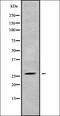 BPI Fold Containing Family A Member 1 antibody, orb336370, Biorbyt, Western Blot image 