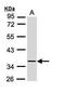 Cellular Communication Network Factor 4 antibody, PA5-29150, Invitrogen Antibodies, Western Blot image 